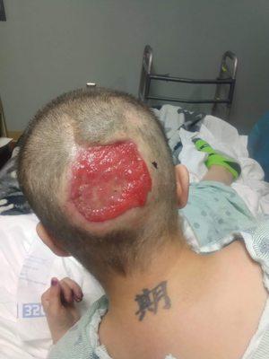 My head after accident