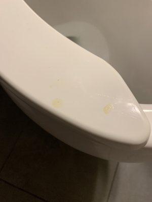 Uncleaned toilet seat