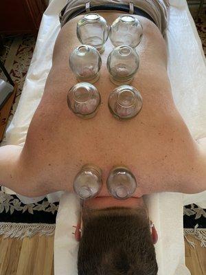 Cupping session.