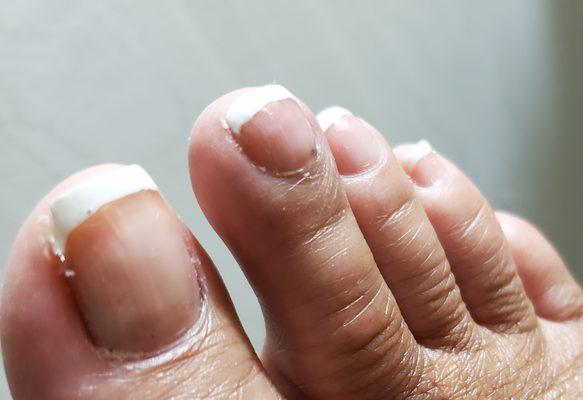 Close-up view of pedicure. No cuticle cleaning, sloppy polish and in what world is thin?