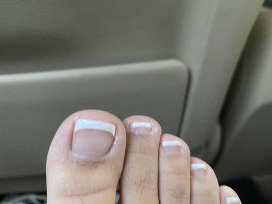 Nail polish all over, cut my nail short after I asked NOT To cut. Dried my toes out.