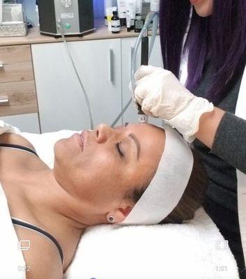 Hydrafacial! Exfoliate, Extract sebum/blackheads and Infuses serums.