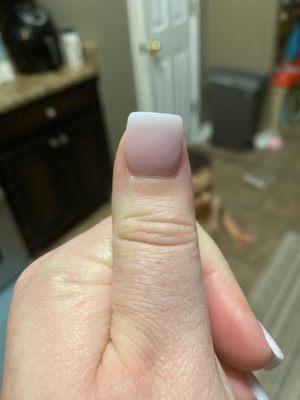 Thumb is STILL crooked after him supposedly fixing it