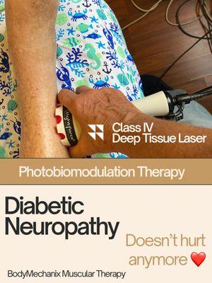 Deep Tissue Laser Therapy (ClassIV) LiteCure