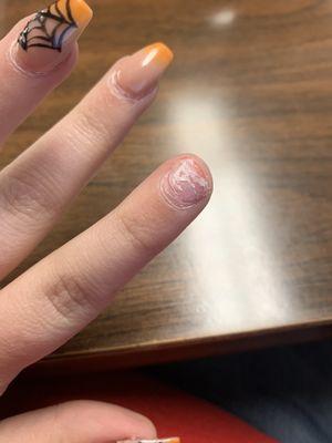 Damaged nails