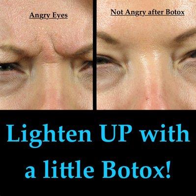 Start early to prevent permanent wrinkles!