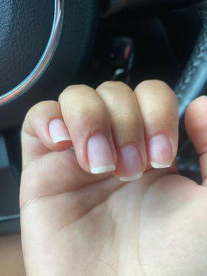 Bleeding cuticle and indentations in real nails.