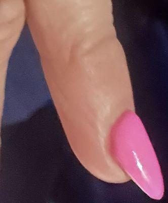 So thick that the nails appear deformed and lifting