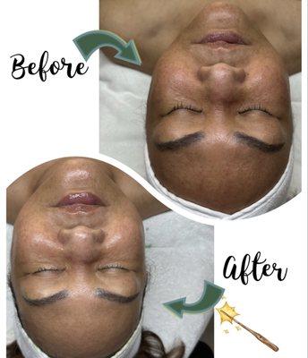 Brightening facial