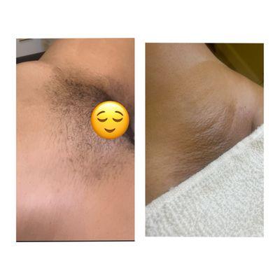 A smooth brazilian wax!