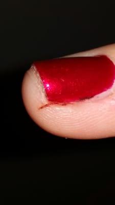 My finger sliced by the metal cuticle pusher. I was told it was "because of your skin, not our tools." The technician was the manager.