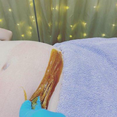 Sugaring the stomach