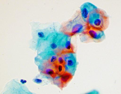 CYTQ™ is the premier provider of Cytopathology services, capable of fulfilling unique practice requirements.