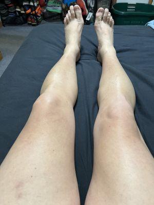 Wax legs