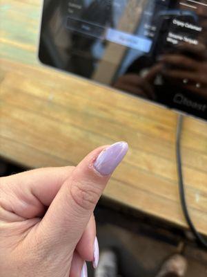 Chipped nail