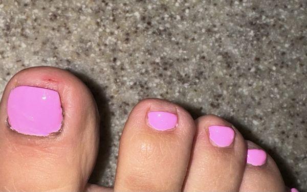 Not even and cut up toes from pedicure