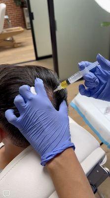 PRP Hair Restoration