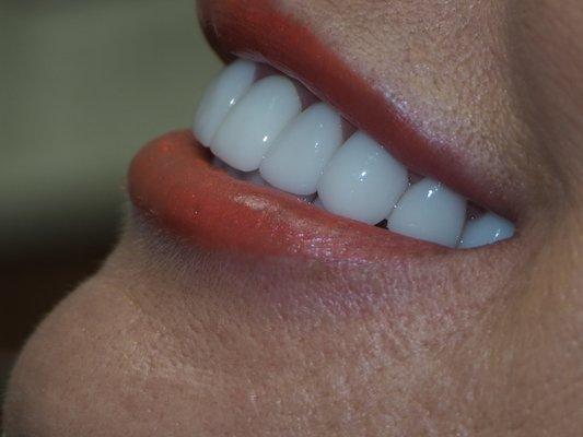 Designing every smile with Synergy!