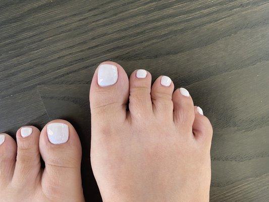 slanted and extreme short big toe nail is her thing!