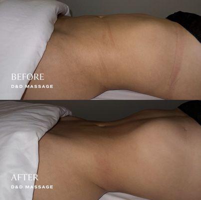 Before and After of the Detox and Debloat Massage by Chateaux Muse