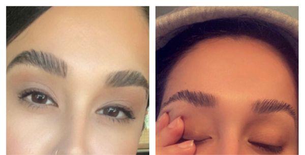 Before (left) and After (right) Brow Arc