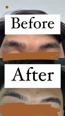 Before and after