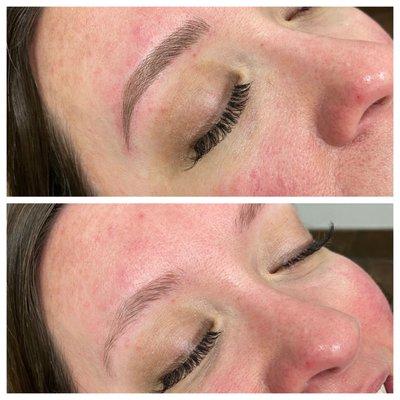 Microblading