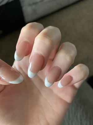 Oval shaped, lumpy nails