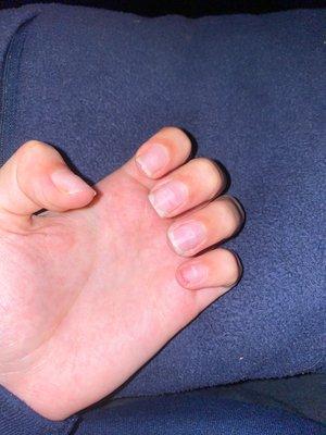 Damaged nails