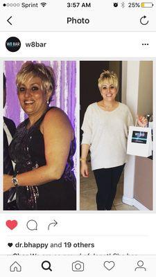 Another star patient, Janet lost over 30 lbs in 40 days at W8 bar