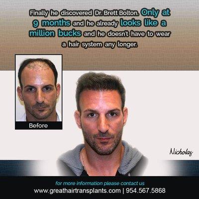 check more @ https://www.greathairtransplants.com/patient/p183/nicholas/