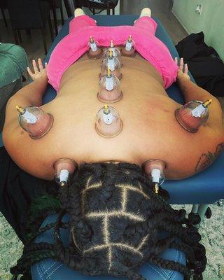 Cupping session