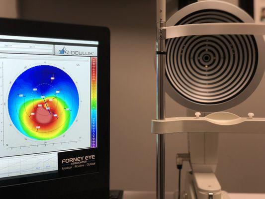 State-of-art equipment to diagnose and treat kerstoconus