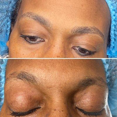 Before and After Microblading