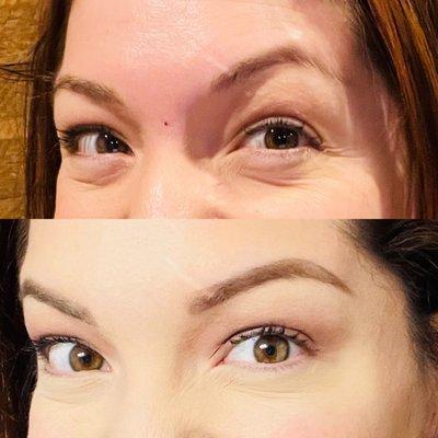 Crows feet before and after