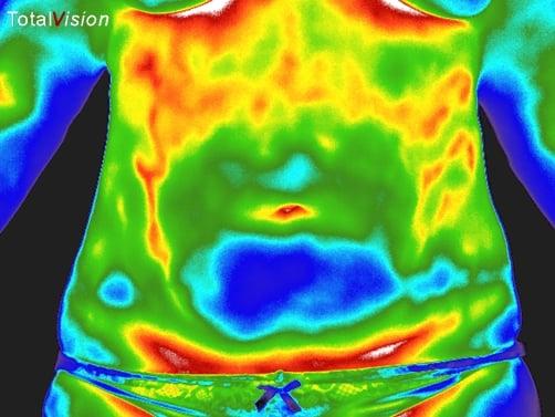 Thermal image of the abdomen. Here, we can look for food sensitivities, digestive issues and again, inflammation