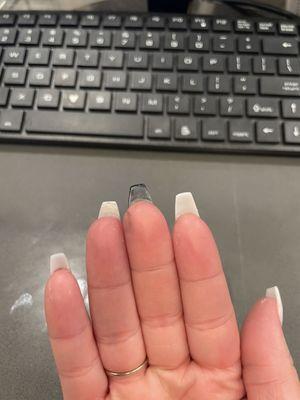 Crooked nails, nails are longer than one another