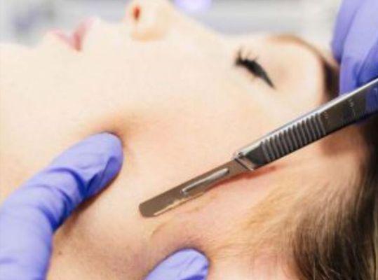 Dermaplaning is a great service that Lash and Company Med Spa offers. Call 303-255-4705