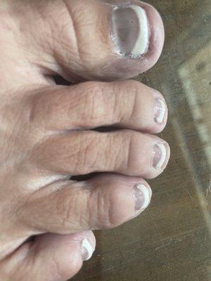 Terrible pedicure