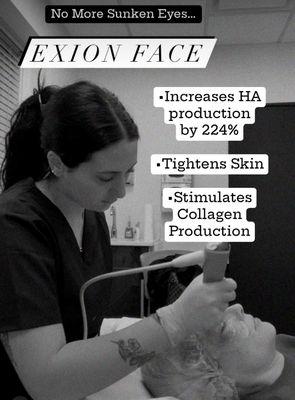 Exion Face
 -Increases HA production by 224%
 -Tightens Skin
 -Stimulates Collagen Production