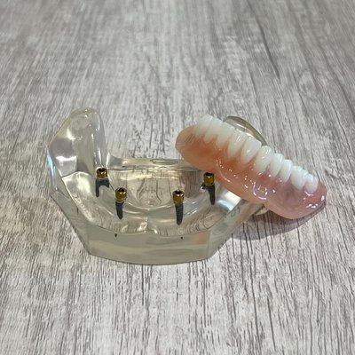 Reno Dentures and Implants