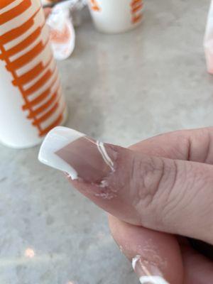 Glue, thumb nail edge not filed correctly OBVIOUSLY