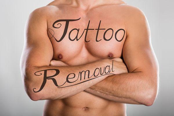 Tatto Removal for all colors