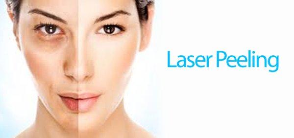 We use Sciton laser for best results