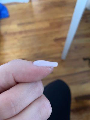 Woooooof. The lumps are just so bad. Every single nail looks like this.