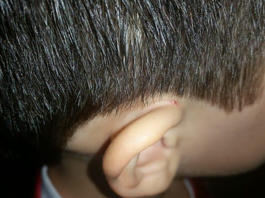 I don't know why the service getting worse after 4 years client with them.They cut my son's ear that hurting so much.