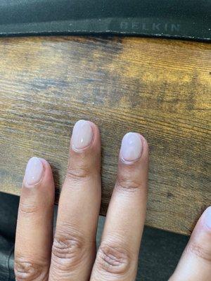 You can see where my nail typically lays on my fingertips. This picture is four days later. They were cut without me telling her to.