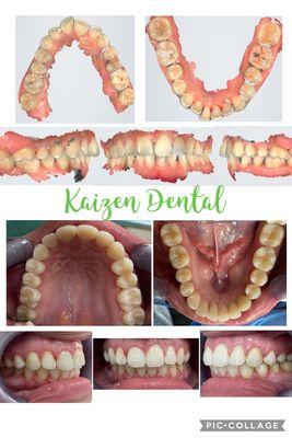 Kaizen Dental