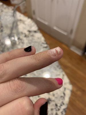 Torn nail from removal process