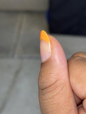 nail not cleaned up